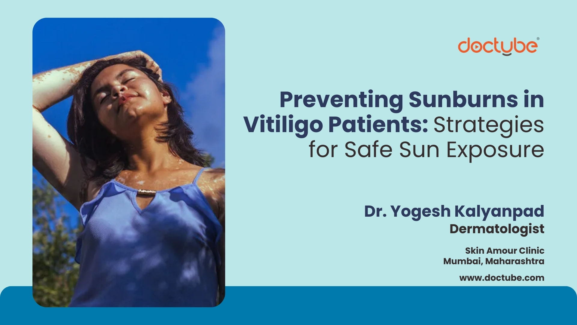 Preventing Sunburns in Vitiligo Patients: Strategies for Safe Sun Exposure